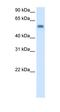 Monoamine Oxidase B antibody, orb330316, Biorbyt, Western Blot image 