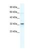 Gap Junction Protein Beta 1 antibody, NBP1-59139, Novus Biologicals, Western Blot image 