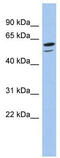 Zinc Finger Protein 248 antibody, TA339525, Origene, Western Blot image 