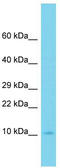 Ubiquitin Conjugating Enzyme E2 D4 (Putative) antibody, TA330654, Origene, Western Blot image 