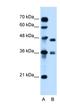 N-Methylpurine DNA Glycosylase antibody, NBP1-59730, Novus Biologicals, Western Blot image 