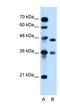 DNA-3-methyladenine glycosylase antibody, NBP1-59730, Novus Biologicals, Western Blot image 