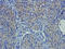 Mucin 16, Cell Surface Associated antibody, orb10214, Biorbyt, Immunohistochemistry paraffin image 