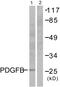 Platelet Derived Growth Factor Subunit B antibody, abx013175, Abbexa, Western Blot image 