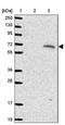 Anoctamin 10 antibody, PA5-62435, Invitrogen Antibodies, Western Blot image 