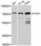 Peptidyl Arginine Deiminase 2 antibody, STJ114127, St John