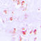 Creatine Kinase, M-Type antibody, LS-C352028, Lifespan Biosciences, Immunohistochemistry paraffin image 