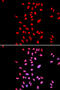 Dyskerin Pseudouridine Synthase 1 antibody, 18-354, ProSci, Immunofluorescence image 