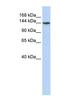 ATPase Phospholipid Transporting 11B (Putative) antibody, NBP1-59962, Novus Biologicals, Western Blot image 