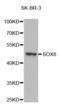 SRY-Box 8 antibody, abx002249, Abbexa, Western Blot image 