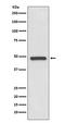 Paired Box 8 antibody, M00943-2, Boster Biological Technology, Western Blot image 