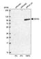 ASH2 Like, Histone Lysine Methyltransferase Complex Subunit antibody, PA5-59937, Invitrogen Antibodies, Western Blot image 