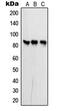 Phosphofructokinase, Platelet antibody, MBS820451, MyBioSource, Western Blot image 