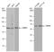 Checkpoint Kinase 2 antibody, GTX70100, GeneTex, Western Blot image 