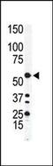 Integrin Linked Kinase antibody, PA5-14680, Invitrogen Antibodies, Western Blot image 