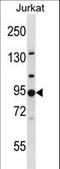 Adaptor Related Protein Complex 1 Subunit Gamma 2 antibody, LS-C156380, Lifespan Biosciences, Western Blot image 