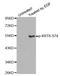 Keratin 8 antibody, LS-C336029, Lifespan Biosciences, Western Blot image 