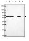 Glycerophosphodiester Phosphodiesterase Domain Containing 5 antibody, HPA065257, Atlas Antibodies, Western Blot image 