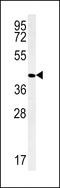 Peter Pan Homolog antibody, 57-374, ProSci, Western Blot image 
