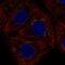 Androgen Induced 1 antibody, NBP2-38897, Novus Biologicals, Immunofluorescence image 