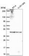 BLOC-1 Related Complex Subunit 6 antibody, NBP2-56321, Novus Biologicals, Western Blot image 