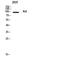 AXL Receptor Tyrosine Kinase antibody, A00226-3, Boster Biological Technology, Western Blot image 