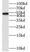 StAR Related Lipid Transfer Domain Containing 3 antibody, FNab05221, FineTest, Western Blot image 