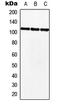 Myocardin Related Transcription Factor B antibody, MBS822019, MyBioSource, Western Blot image 