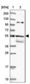 ALG3 Alpha-1,3- Mannosyltransferase antibody, NBP1-91658, Novus Biologicals, Western Blot image 