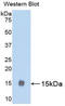 Luteinizing Hormone Beta Polypeptide antibody, LS-C304557, Lifespan Biosciences, Western Blot image 