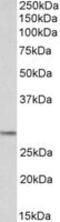 Proopiomelanocortin antibody, MBS420379, MyBioSource, Western Blot image 