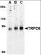 Transient Receptor Potential Cation Channel Subfamily C Member 6 antibody, orb86808, Biorbyt, Western Blot image 