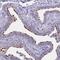 Transmembrane Protein 138 antibody, PA5-59960, Invitrogen Antibodies, Immunohistochemistry frozen image 