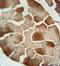 Complement Factor B antibody, GTX80605, GeneTex, Immunohistochemistry paraffin image 