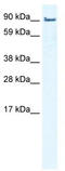 LIM Domain And Actin Binding 1 antibody, TA335562, Origene, Western Blot image 