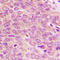 PDZ Binding Kinase antibody, LS-C358833, Lifespan Biosciences, Immunohistochemistry frozen image 