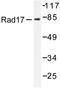 RAD17 Checkpoint Clamp Loader Component antibody, LS-C176298, Lifespan Biosciences, Western Blot image 