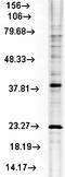 Heat Shock Protein Family B (Small) Member 8 antibody, orb67375, Biorbyt, Western Blot image 