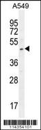 SRY-Box 3 antibody, 56-211, ProSci, Western Blot image 