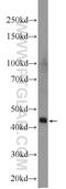 Zinc Finger DHHC-Type Containing 13 antibody, 24759-1-AP, Proteintech Group, Western Blot image 