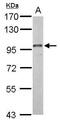 Dynamin 3 antibody, GTX127933, GeneTex, Western Blot image 