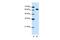 DIS3 Like 3'-5' Exoribonuclease 2 antibody, GTX47208, GeneTex, Western Blot image 