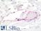 Lymphatic Vessel Endothelial Hyaluronan Receptor 1 antibody, LS-B10511, Lifespan Biosciences, Immunohistochemistry paraffin image 