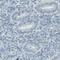 Solute Carrier Family 27 Member 5 antibody, AMAb90575, Atlas Antibodies, Immunohistochemistry paraffin image 