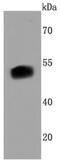 Forkhead Box A2 antibody, NBP2-66890, Novus Biologicals, Western Blot image 