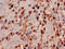 Mitochondrial Ribosomal Protein L19 antibody, CSB-PA014826EA01HU, Cusabio, Immunohistochemistry paraffin image 