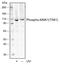 Ribosomal Protein S6 Kinase A5 antibody, MA5-28080, Invitrogen Antibodies, Western Blot image 