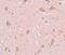 Signal Induced Proliferation Associated 1 Like 1 antibody, PA5-20847, Invitrogen Antibodies, Immunohistochemistry frozen image 