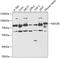 NDC80 Kinetochore Complex Component antibody, 15-371, ProSci, Western Blot image 