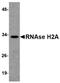 Ribonuclease H2 Subunit A antibody, orb75125, Biorbyt, Western Blot image 